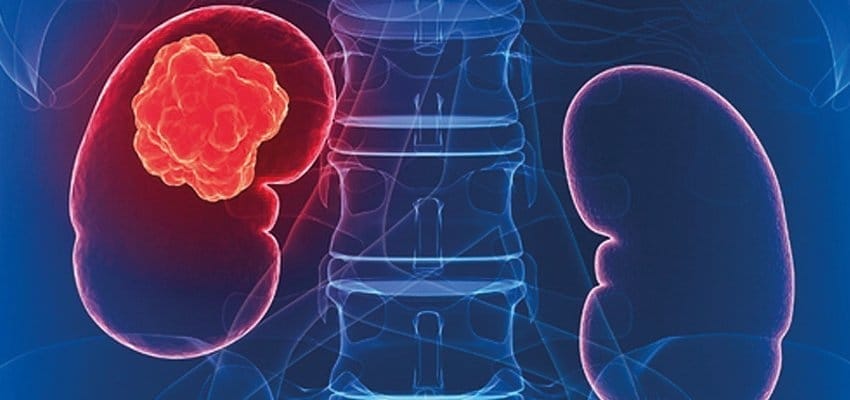 a63cd9e38964634741a5a3fe89055308